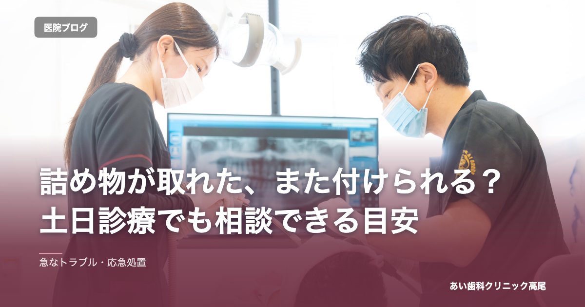 詰め物が取れた、また付けられる？土日診療でも相談できる目安 のアイキャッチ画像