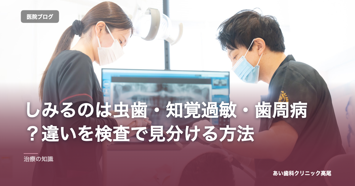 しみるのは虫歯・知覚過敏・歯周病？違いを検査で見分ける方法 のアイキャッチ画像